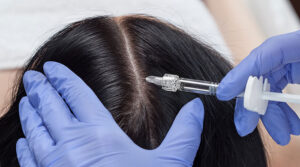 Hair filler mayfair, london