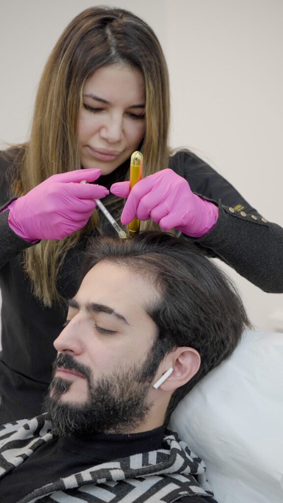 Hair Treatment - PRP in London
