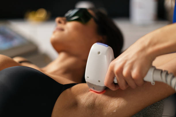 permanent hair removal methods