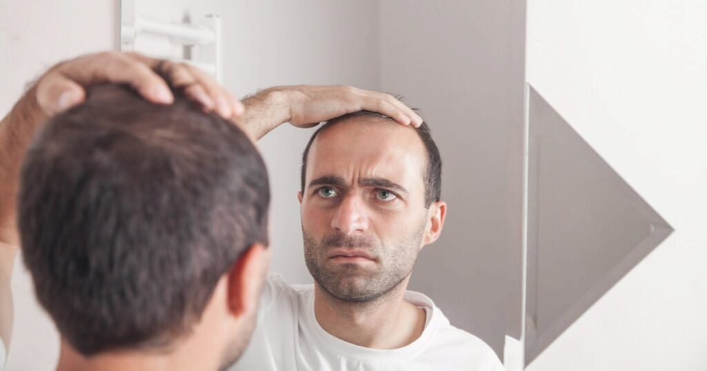 How to Stay Confident During Hair Loss Treatment